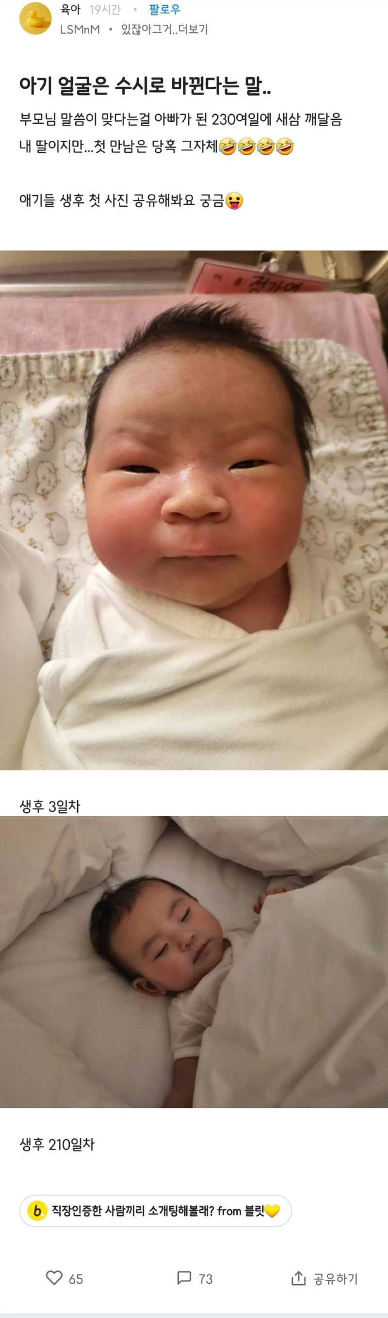 생후 3일차 vs 210일차