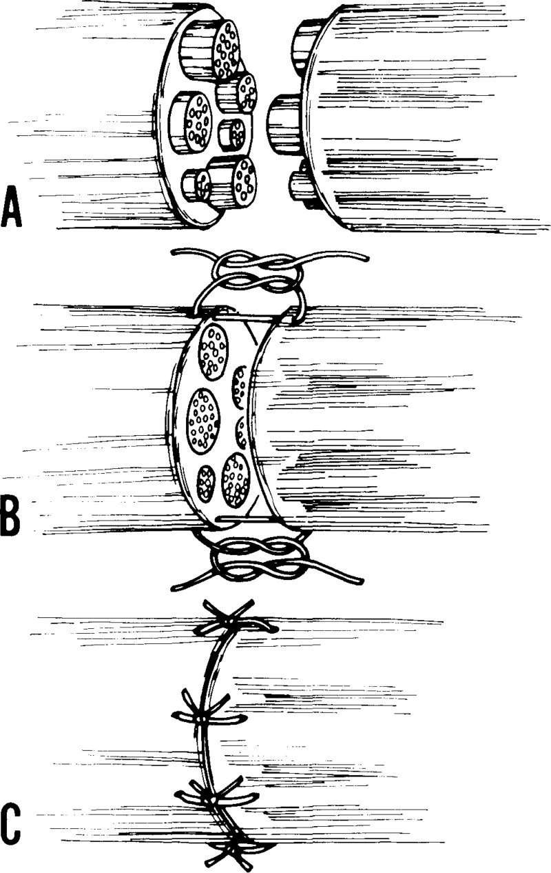 10.1177_107110079601700713-fig2.jpg