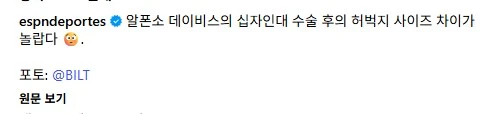 어느 축구 선수의 십자인대 수술 후 허벅지_2.png