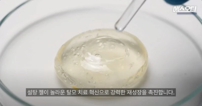 탈모인 희소식...설탕(?) 바르면 머리 자라남